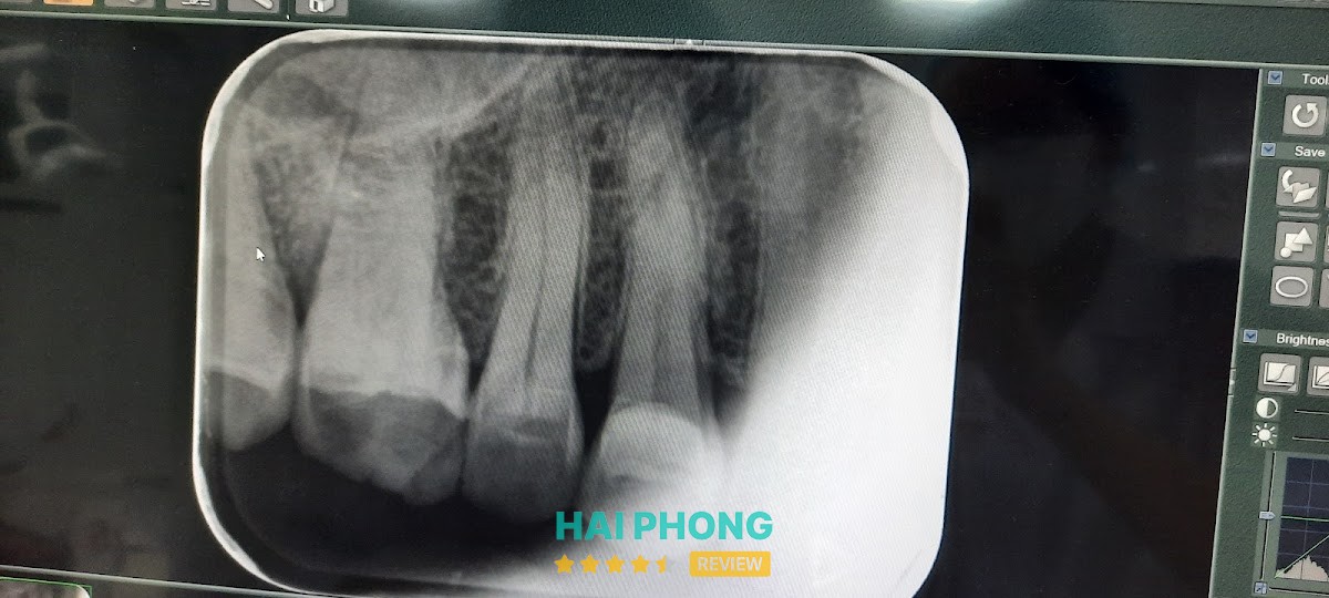 Nha Khoa Phố Cổ Hải Dương – hình ảnh 3