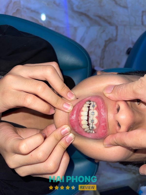 Khu vực điều trị Nha Khoa Hoa Phượng