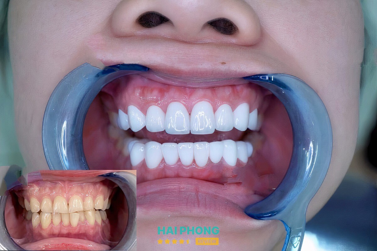 Khu vực chăm sóc răng tại Nha khoa MINH CHÂU
