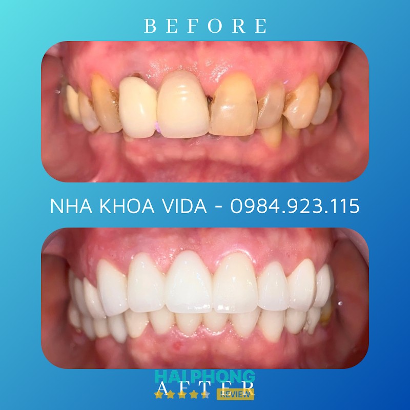 Không gian Nha Khoa VIDA