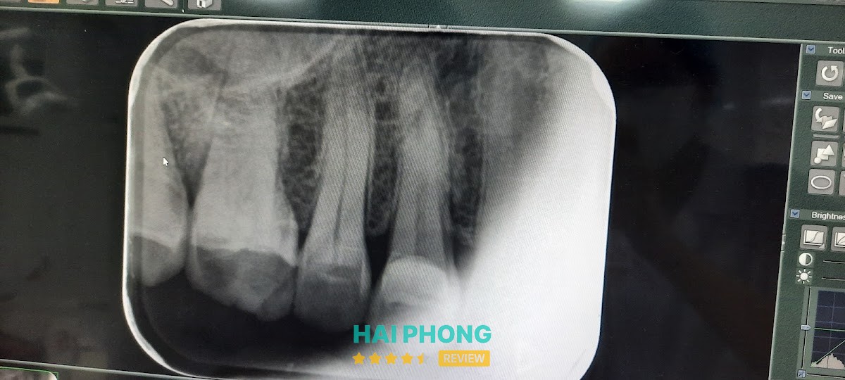 Hình ảnh Nha Khoa Phố Cổ Hải Dương