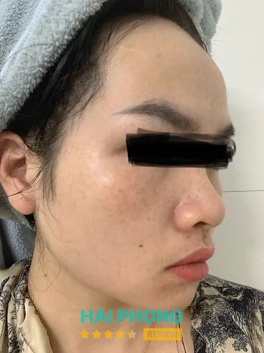 Thẩm Mỹ Viện Ngọc Dung – hình ảnh 2