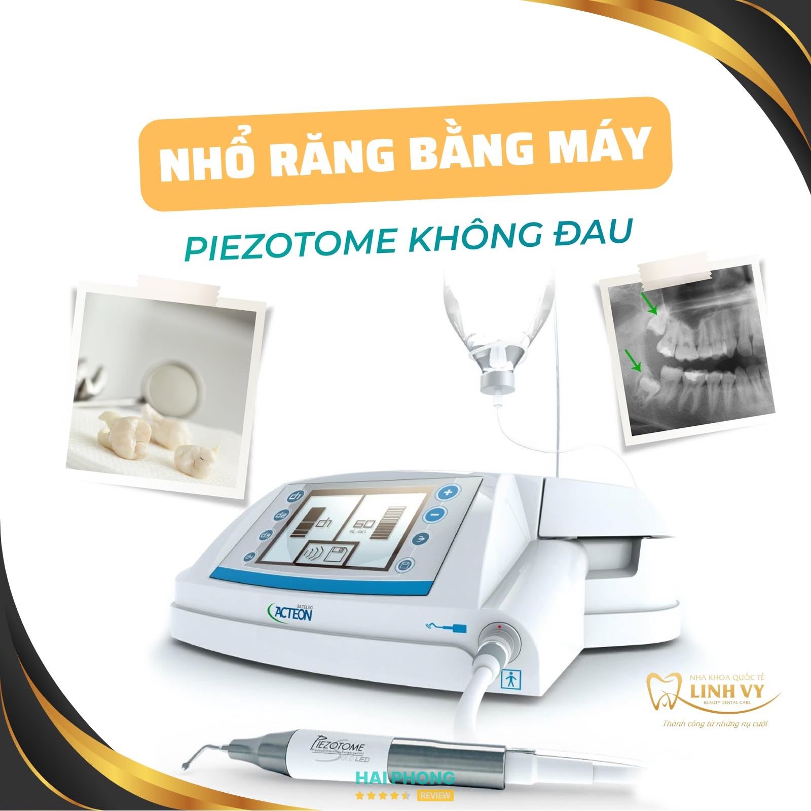 Khu vực chăm sóc răng tại Nha khoa Linh Vy