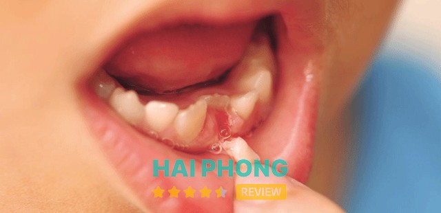 Trang thiết bị Răng Hàm Mặt 108 Hải Phòng