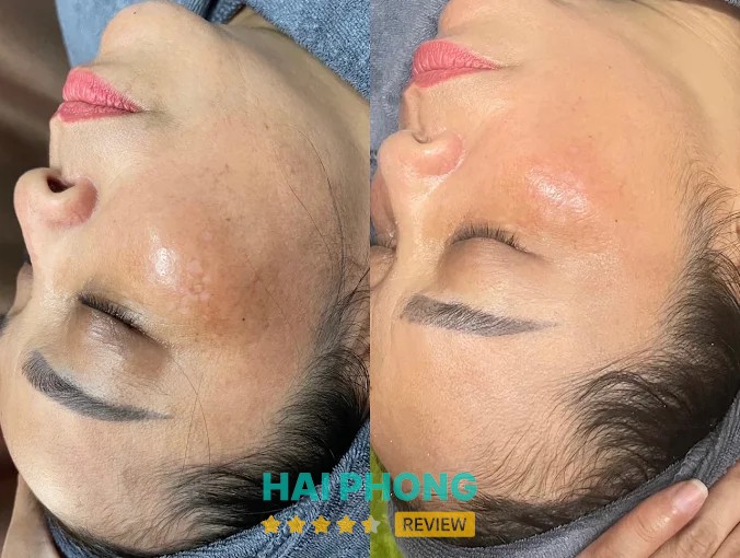 Dịch vụ làm đẹp tại Thẩm Mỹ Phương Yến